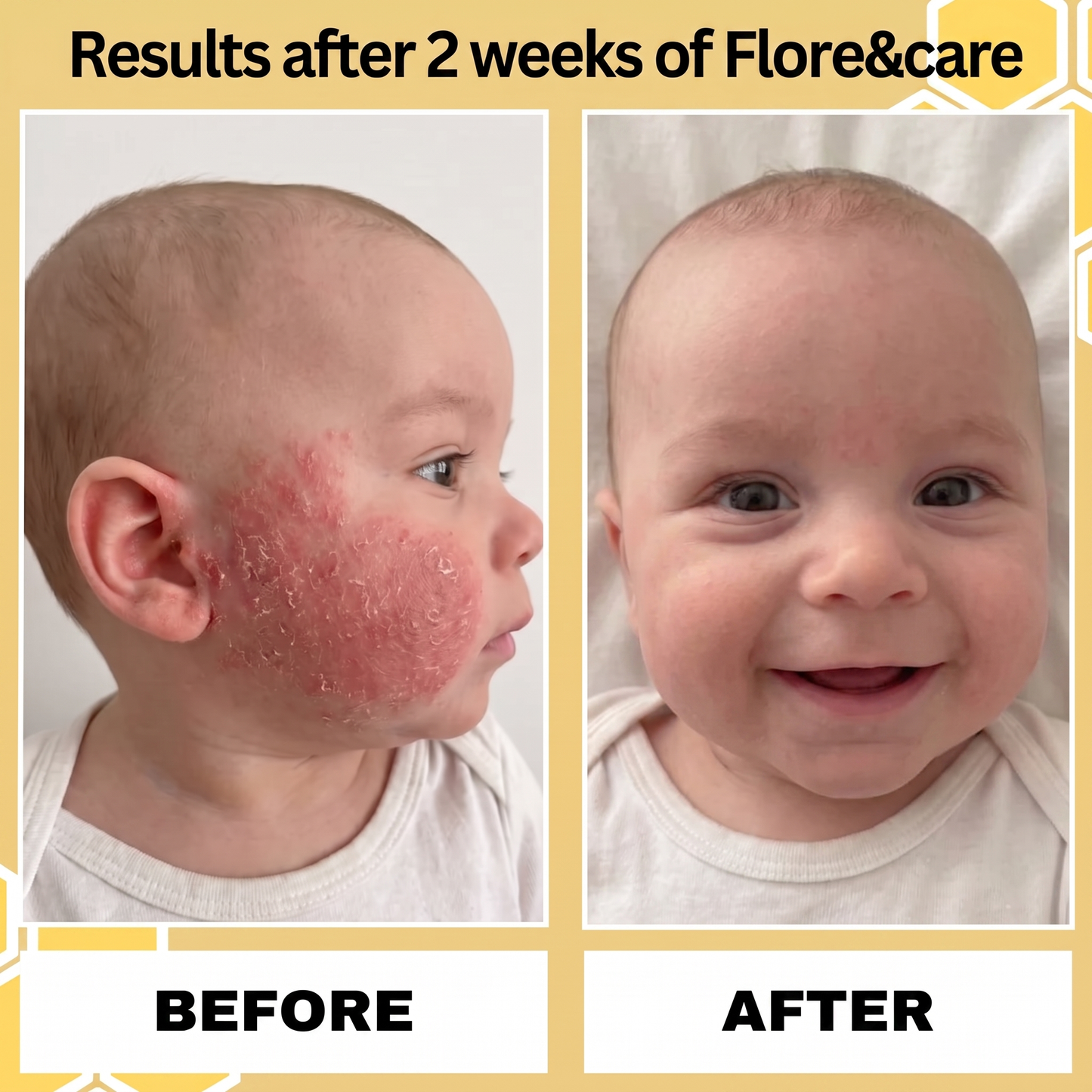 Eczema Honey Original Skin-Soothing Cream